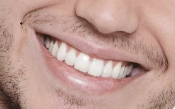 Dan ong so huu nhung not ruoi nay trang hoa da tinh-Hinh-2