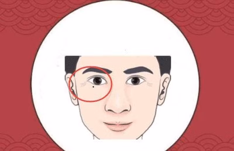 Nốt ruồi dưới bọng mắt và bụng. Trong tướng số nốt ruồi, nếu người có nốt ruồi ở mắt và bụng là nốt ruồi điển hình của vận trình lao lực, tài vận không đủ, ngay cả con cái cũng không có triển vọng lớn, thậm chí còn phải dựa dẫm vào người khác để kiếm tiền nuôi gia đình.