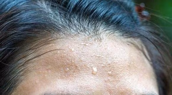 Thuong xuyen do mo hoi o nhung vung nay, dung chu quan-Hinh-2