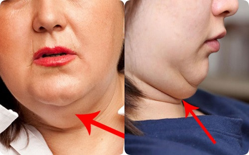 2. Hai cằm. Về nhân tướng học, người hai cằm có khả năng giao tiếp tốt, càng già càng có lộc. Họ cũng có tính ôn hòa, nhân hậu và chịu khó học hỏi, hay giúp đỡ người khác. Ảnh: Công lý &amp; xã hội