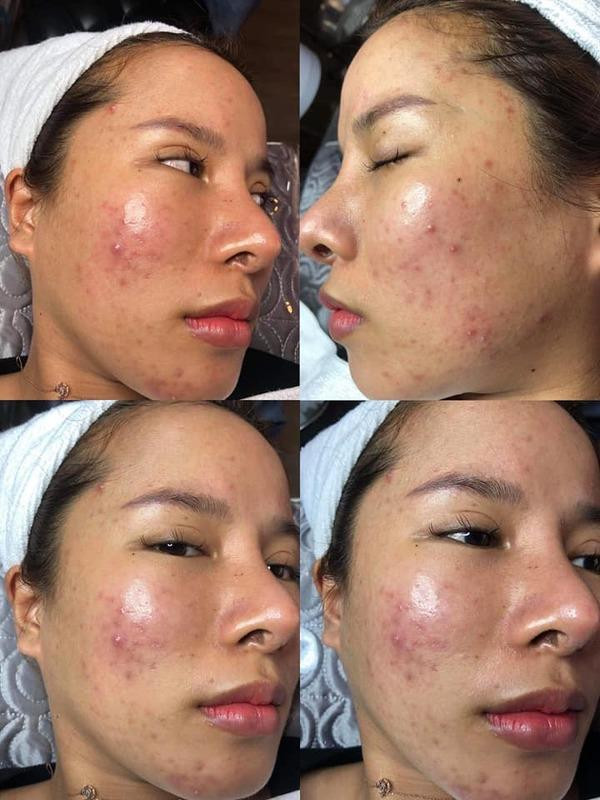 Ba Nhan Vlog lo mat moc, nhan sac that gay to mo-Hinh-3