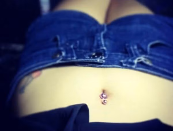 Chỗ khuyên rốn của My đã từng bị đứt.