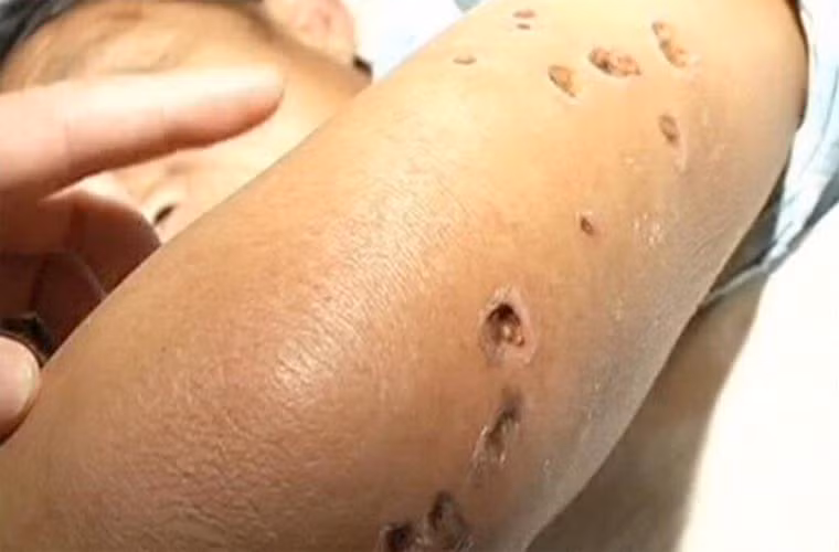 Loài này sống chủ yếu ở vùng Primirsky Krai của Nga, Trung Quốc, Đài Loan, Đông Dương, Nepal, Ấn Độ, Sri Lanka…