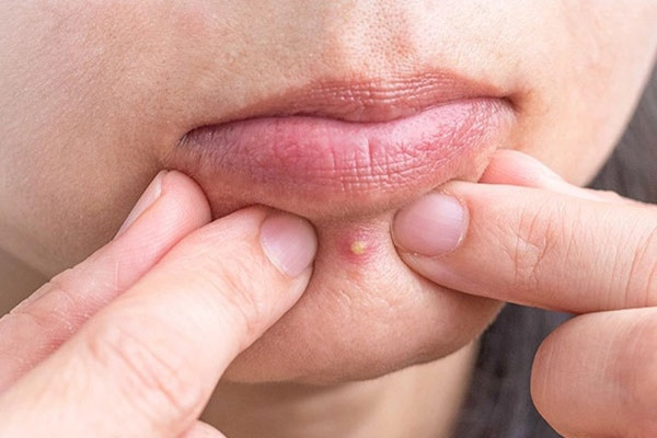 4 dau hieu tren khuon mat canh bao tu cung suy yeu-Hinh-2