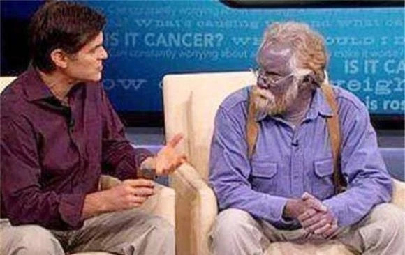 "Người da xanh" hiếm hoi trên thế giới sống ẩn dật trên đỉnh núi ảnh 2