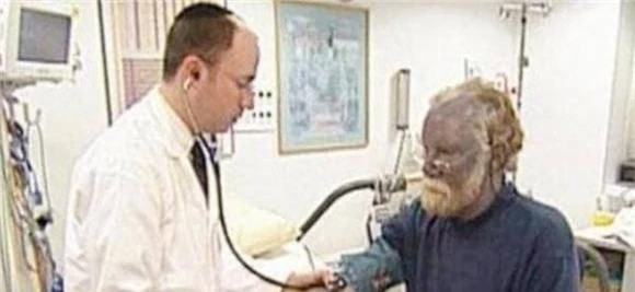 "Người da xanh" hiếm hoi trên thế giới sống ẩn dật trên đỉnh núi ảnh 3