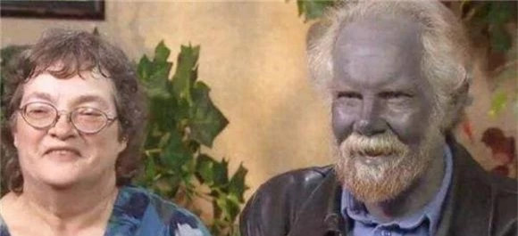 "Người da xanh" hiếm hoi trên thế giới sống ẩn dật trên đỉnh núi ảnh 4