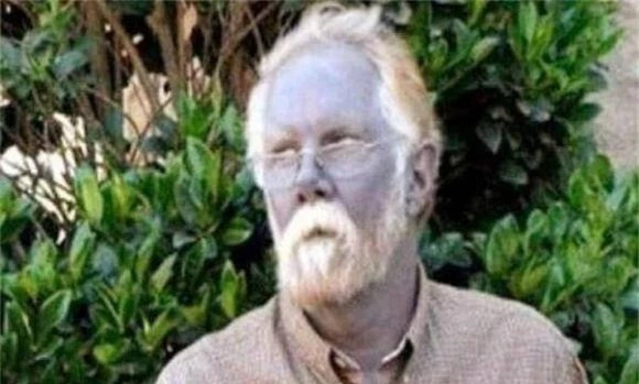 "Người da xanh" hiếm hoi trên thế giới sống ẩn dật trên đỉnh núi ảnh 1