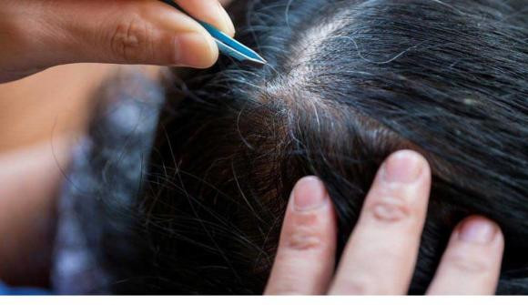 3 ly do khong nen nho toc bac