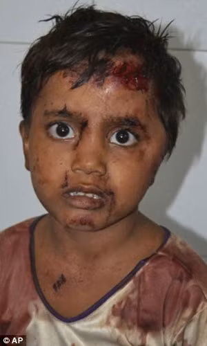 Đau lòng và đáng thương nhất là nhiều trẻ em cũng trở thành nạn nhân của các vụ đụng độ chết người ở Muzaffarnagar, bang Uttar Pradesh và đang phải điều trị trong bệnh viện.