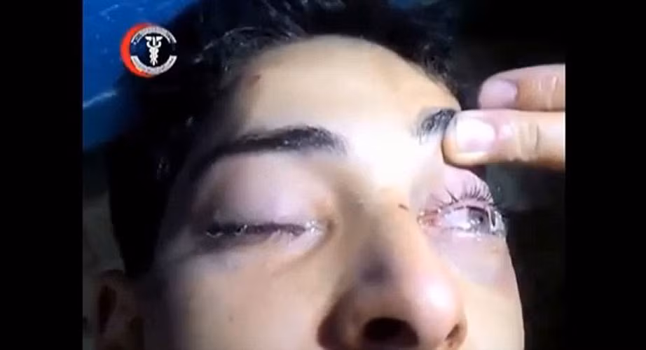 là những nạn nhân khác đang trong giờ phút hấp hối, vật lộn trong đau đớn...