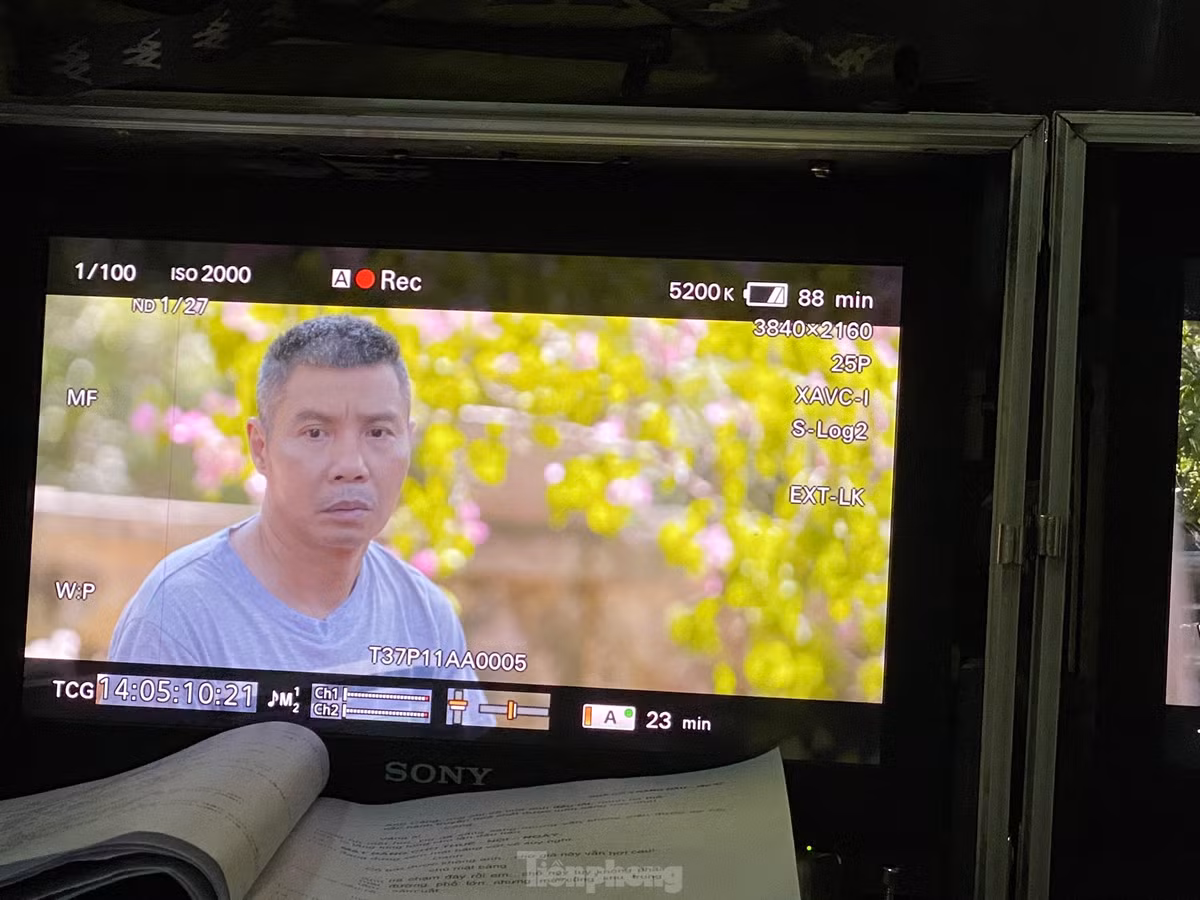 Tháng 7/2021, NSND Công Lý nhập viện cấp cứu sau khi bị ngã do trượt chân trên sàn nhà và phải nhập viện điều trị trong 3 tháng. Sau khi xuất viện, anh tiếp tục điều trị theo phác đồ riêng của bác sĩ. "Hiện tại, sức khỏe anh Lý tốt, tinh thần phấn chấn, ăn được ngủ được. Anh cũng chăm chỉ tập thể dục, trị liệu để nhanh chóng lấy lại sức khỏe cũng như vóc dáng. Không chỉ thế, thỉnh thoảng anh Lý còn giúp tôi làm việc nhà”, bà xã NSND Công Lý tiết lộ. Những lần sang Nhật Bản điều trị bệnh cũng giúp sức khỏe nam nghệ sĩ tốt lên trông thấy.