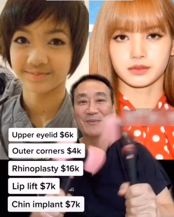 Bac si khang dinh BlackPink phau thuat tham my nhieu-Hinh-5