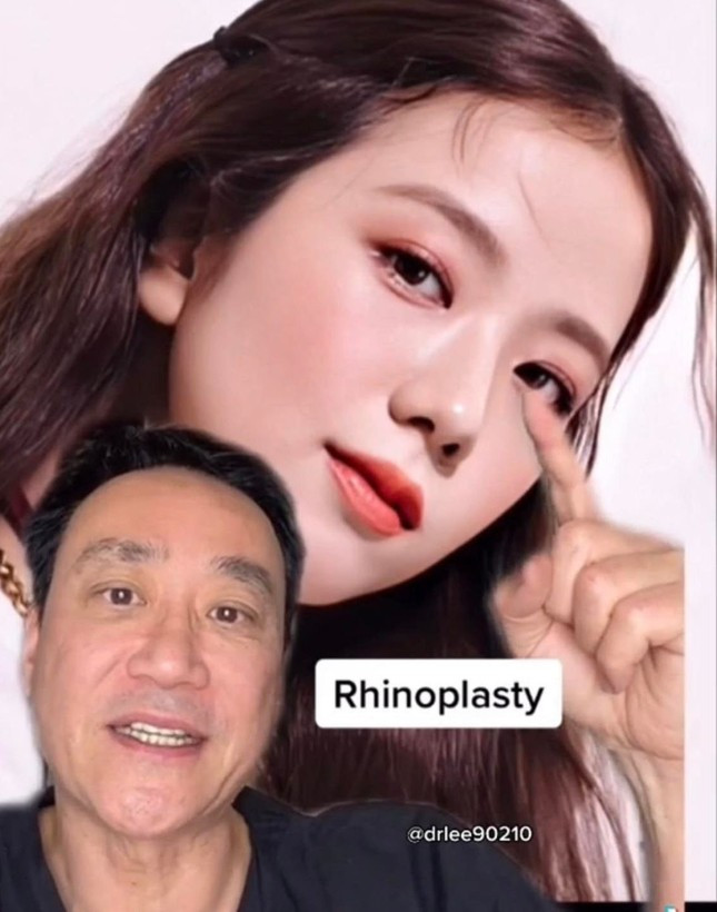 Bac si khang dinh BlackPink phau thuat tham my nhieu-Hinh-3