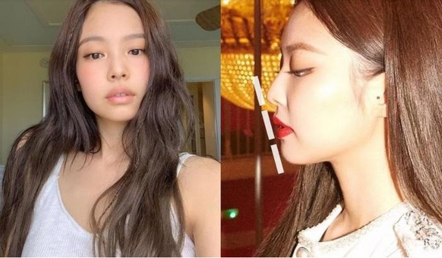 Bac si khang dinh BlackPink phau thuat tham my nhieu-Hinh-2