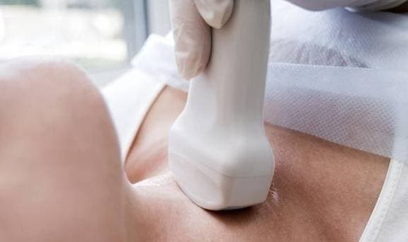 Da tim ra “thien dich” goc cua nhan giap-Hinh-6