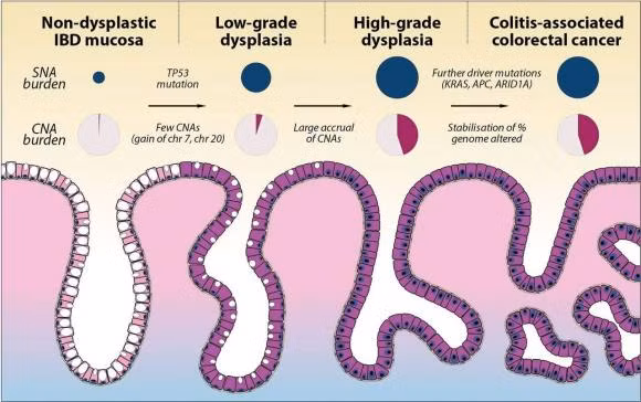 4 loai chong ung thu + 4 loai thuc pham gay ung thu