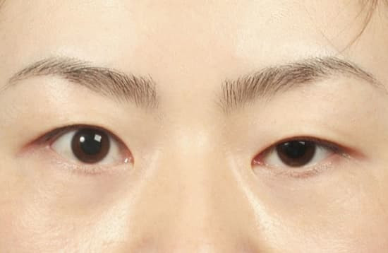 6 dau hieu xuat hien tren mat bao hieu van den sap ap den-Hinh-5