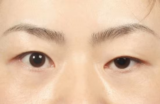 6 dau hieu xuat hien tren mat bao hieu van den sap ap den-Hinh-5