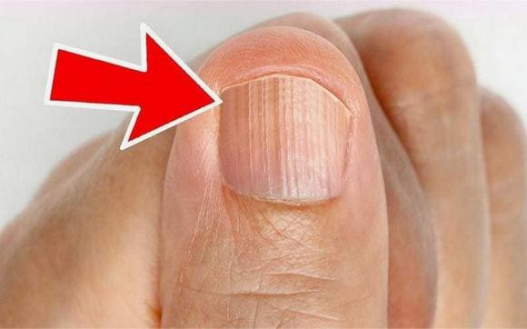 Mong tay co “duong thang dung” la 3 “benh” buoc vao cua