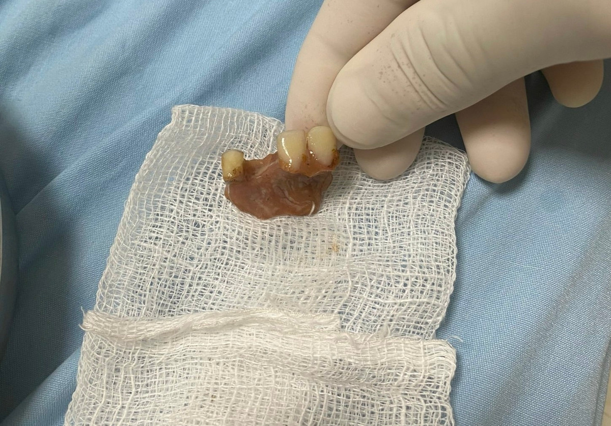 Uong thuoc, nuot nham ca rang gia-Hinh-2