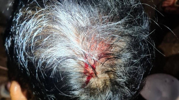 Dong Nai: Thanh vien SOS Dau Giay bi hai ke la mat hanh hung-Hinh-2