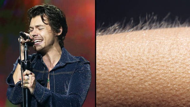 Vì sao có hiện tượng nổi da gà? Vi sao co hien tuong noi da ga?