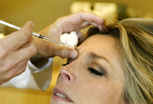 Botox: Nếu bạn bị nhiều nếp nhăn ở trán, tiêm Botox và Dysport có thể là giải pháp tạm thời. Hai loại này chứa độc tố tinh khiết của vi khuẩn độc. Với liều lượng rất nhỏ, chất độc này sẽ làm giãn cơ mặt, căng da. Quá trình tiêm mất vài phút và có thể khiến bạn hơi khó chịu.