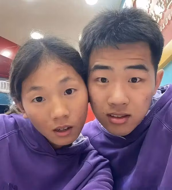 Cap doi giong het nhau duoc de nghi xet nghiem ADN