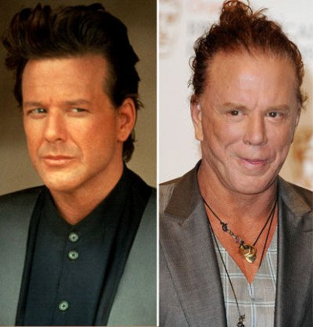 Mickey Rourke là một ngôi sao điện ảnh nổi tiếng xuất thân từ làng quyền anh. Ông thừa nhận rằng ông đã đi chỉnh sửa mũi rất nhiều do những chấn thương khi thi đấu quyền anh gây ra. Nhưng xem chừng chiếc mũi sau chỉnh sửa vẫn lệch và không cân xứng.