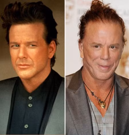Mickey Rourke là một ngôi sao điện ảnh nổi tiếng xuất thân từ làng quyền anh. Ông thừa nhận rằng ông đã đi chỉnh sửa mũi rất nhiều do những chấn thương khi thi đấu quyền anh gây ra. Nhưng xem chừng chiếc mũi sau chỉnh sửa vẫn lệch và không cân xứng.