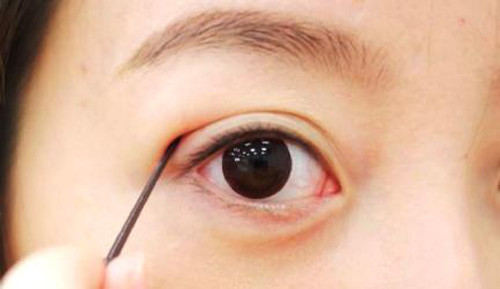 Cắt mí mắt. Ngày càng nhiều người tìm đến cắt mắt hoặc phẫu thuật mí mắt. Mí mắt rũ xuống có thể ảnh hưởng đến tầm nhìn cũng như khiến bạn trông già hơn tuổi. Một vết mổ được thực hiện trên mí mắt và các phần da thừa bị loại bỏ. Mí mắt sau đó được khâu lại cẩn thận và sau khi mắt lành thì để lại một vết sẹo rất khó nhìn thấy. Kết quả mang lại rất đáng ngạc nhiên, tạo vẻ trẻ trung hơn cho đôi mắt. Có tới 230.697 ca cắt mí mắt được thực hiện năm 2005, trong đó 86% là phụ nữ.