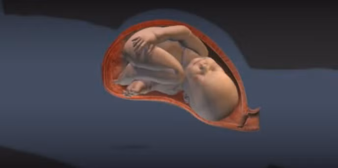 Sinh mổ là sinh em bé qua một đường rạch phẫu thuật ở bụng và tử cung của người mẹ. Trong nhiều trường hợp nhất định, việc sinh mổ sẽ được dự kiến từ trước. Ngoài ra cũng có những trường hợp, việc sinh mổ được thực hiện bất thường để đáp ứng với những biến chứng không lường trước được.