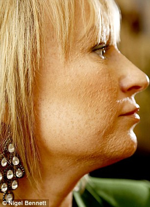 "Aqualyx không phải là phát tiêm giảm cân đơn thuần, mà được sử dụng để tạo đường nét cơ thể và làm thon gọn những vùng mỡ 'cứng đầu, cứng cổ'. Kết hợp với chế độ dinh dưỡng lành mạnh và việc tập luyện, mỡ sẽ chắc chắn sẽ không phát triển trở lại", hãng sáng chế nhấn mạnh.