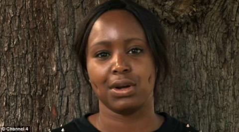 Phẫu thuật thẩm mỹ tạo má lúm, cô gái dính 2 lỗ sâu hoắm trên mặt.