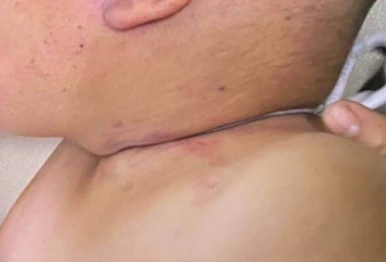 Thuong ta cong an phan tich tam ly ke nhot be trai vao tu cap dong-Hinh-2