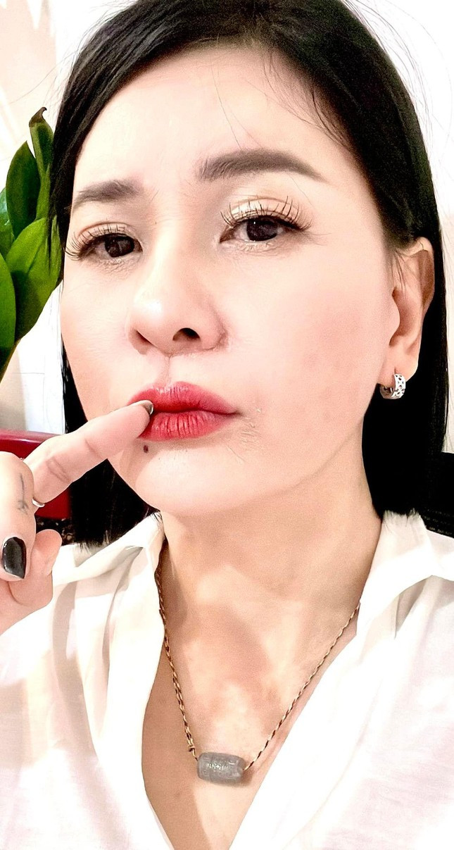 Truoc nghi van can thiep 