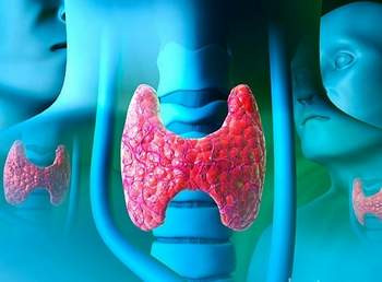 3. Ung thư tủy: hơn 25% trường hợp mắc ung thư này là do gen bất thường. Các khối u phát triển chậm trong khu vực của thyroxine hoặc T4 và rất khó kiểm soát. Ung thư này có nguy cơ lây lan cao hơn đến các bộ phận khác của cơ thể.