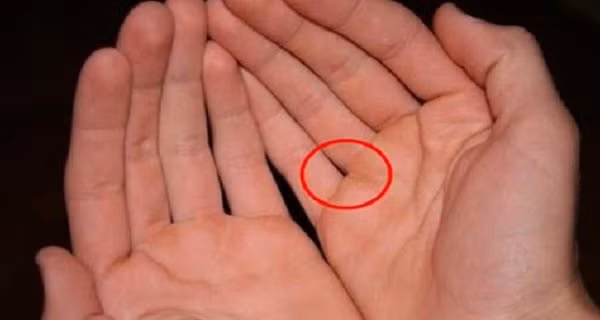 Kẽ hở giữa ngón đeo nhẫn và ngón út. Bạn là người bảo thủ, tự tin quá cao, ít nghe theo lời khuyên bảo của người khác dù đó là người thân hay bạn bè lâu năm. Trong mọi việc, bạn chỉ chăm chăm làm theo ý muốn cá nhân và bỏ ngoài tai ý kiến của người khác. Cũng chính vì vậy, bạn rất dễ mắc sai lầm và không được lòng mọi người.