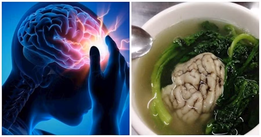 Rối loạn tiền đình, đau đầu, mất ngủ: Ăn thứ này trị dứt điểm! - Hình 2 Roi loan tien dinh, dau dau, mat ngu: An thu nay tri dut diem!-Hinh-2