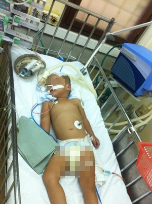 Bệnh nhi đang được điều trị tại bệnh viện Nhi trung ương.