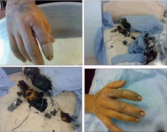 Trong quá trình sạc, nếu các linh kiện điện tử không đảm bảo chất lượng, bị hỏng, mạch nguồn có thể bị đánh thủng dẫn tới việc điện áp cao phóng thẳng tới điện thoại liên tục hoặc tức thì gây hỏng điện thoại và gây giật nguy hiểm cho người sử dụng, nhất là những điện thoại vỏ kim loại.