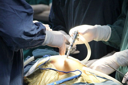 Được biết, Bệnh viện Nhi Trung ương là bệnh viện đầu tiên trong cả nước triển khai phẫu thuật nội soi có ứng dụng robot một cách đồng bộ. Với ứng dụng này Việt Nam là nước thứ 2 ở Châu Á và là nước đầu tiên ở Đông Nam Á ứng dụng thành công công nghệ hiện đại này.