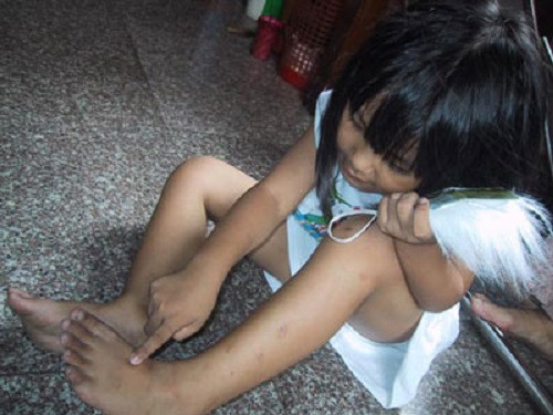 Loài bọ xít hút máu sống bằng máu người hoặc động vật, khi không có động vật chúng sẽ tìm đến người để hút máu. Chúng không những chỉ xuất hiện ở các khu nhà ẩm thấp, tối tăm mà còn có mặt cả ở những khu nhà cao tầng, đầy đủ tiện nghi.