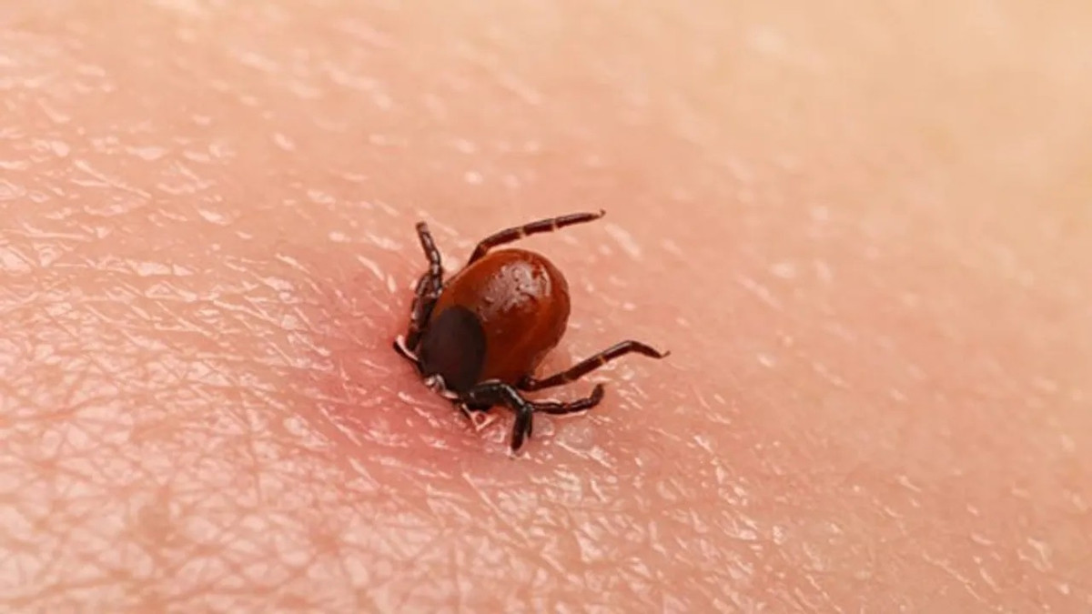 Loai virus co the gay tu vong toi 40% chi sau con sot