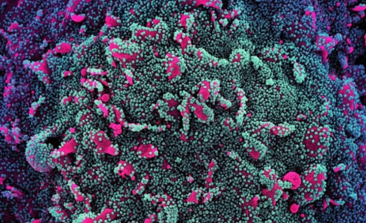 Bien chung BA.5 Omicron vua xam nhap vao Viet Nam nguy hiem the nao?