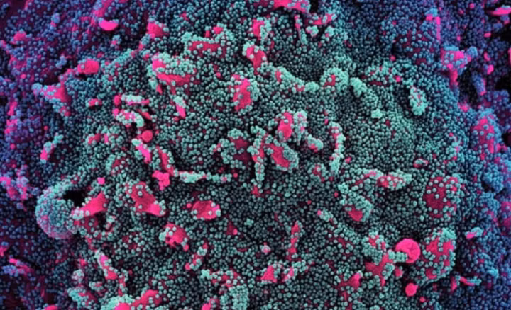 Bien chung BA.5 Omicron vua xam nhap vao Viet Nam nguy hiem the nao?