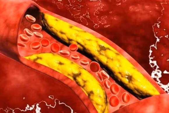 4 nguoi nay nen co gang an ngo it nhat co the-Hinh-3