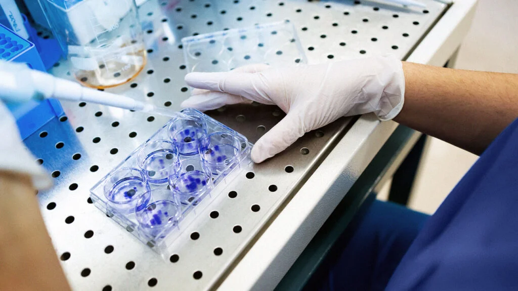 Trien vong ve phuong phap chua tri benh ung thu mau ac tinh-Hinh-3