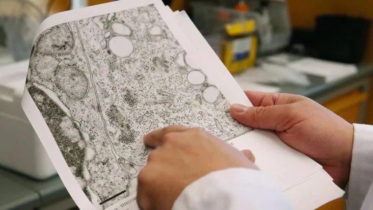 Loai virus gay dich moi, trieu chung co the giong dot quy